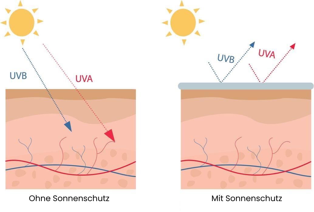 Die Grafik zeigt, wie UVA- und UVB-Strahlen ohne Schutz tief in die Haut eindringen und durch Sonnencreme größtenteils abgeblockt werden.